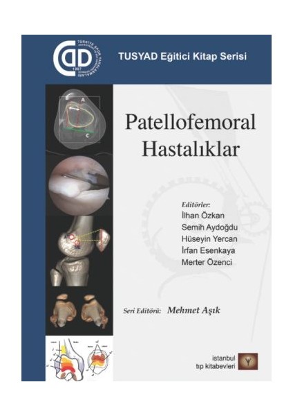 Tusyad Eğitici Kitap Serisi - Patellofemoral Hastalıklar