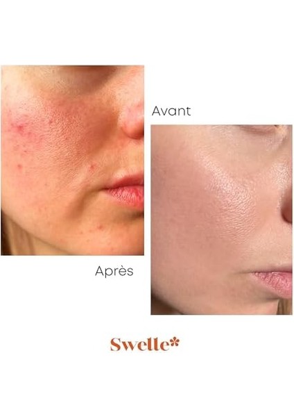 Swelle Ardıç Katranı ve Sandal Ağacı Yağı Sabunu, Derinlemesine Temizlik, Sağlıklı ve Dengeli Cilt, Yüz, Vücut ve Saç Için – Doğal, Paraben Içermez, Erkekler ve Kadınlar Için Ideal fiyatları