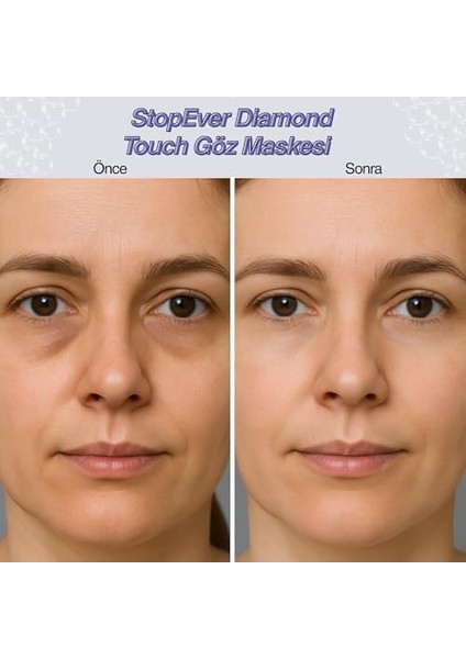Stopever Diamond Touch Göz Maskesi ve Cooling Patch Soğutucu Hidrojel Plaster 2'li Set fiyatları