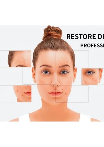 Aee® 4'lü Kutulu Paslanmaz Çelik Komedon Akne Siyah Nokta Sivilce Siğil Temizleyici Çıkarıcı Seti Gümüş