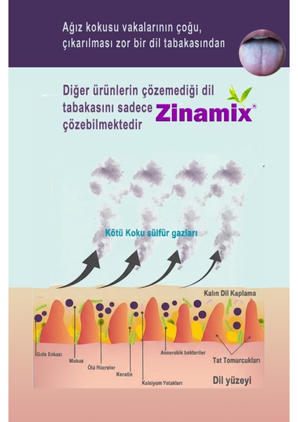 Dil Temizleme Şaseleri – Kötü Nefesin Gerçek Nedenine Yeni, Bilimsel ve Etkili Bakım modelleri