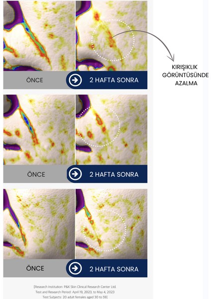 Botox Etkili Serum: Kırışıklık Karşıtı & Yoğun Nemlendirici Formül | Miaderm indirimleri