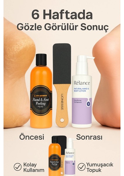 Xpro Harmony Pürüzsüz Topuklar Için 3’lü Ayak Bakım Seti | Ölü Deri Arındırıcı Peeling + Törpü + Losyon fiyatları