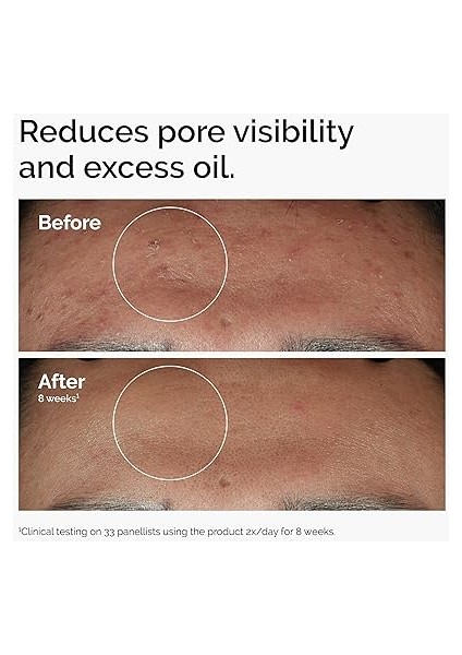 Ordinary Niacinamide 10% + Zink 1% 30ML fiyatları