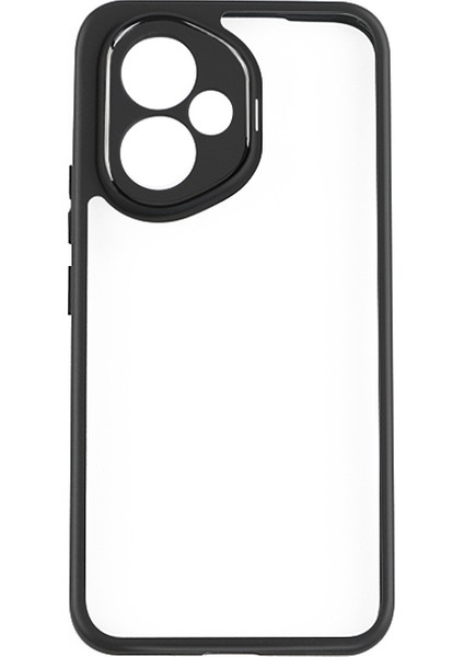 Honor 400 Kılıf Kamera Korumalı Şeffaf Arka Yüzey Nxxa New Roll Kapak - Siyah