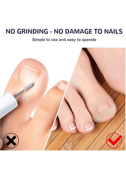 Ayak Tırnağı Düzeltme Bandı 50 Adet modelleri