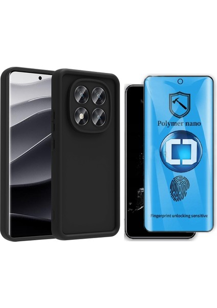 Xiaomi Redmi Note 14 Pro 5G Kılıf Kamera Korumalı Zore Ananas Kapak + Polymer Nano Ekran Koruyucu