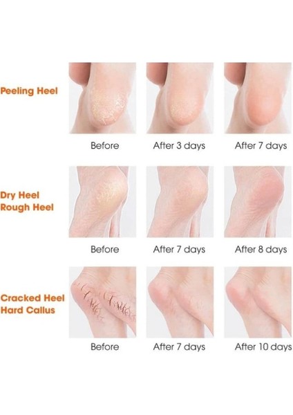 Silikon Topuk Nemlendirici Çorap fırsatları