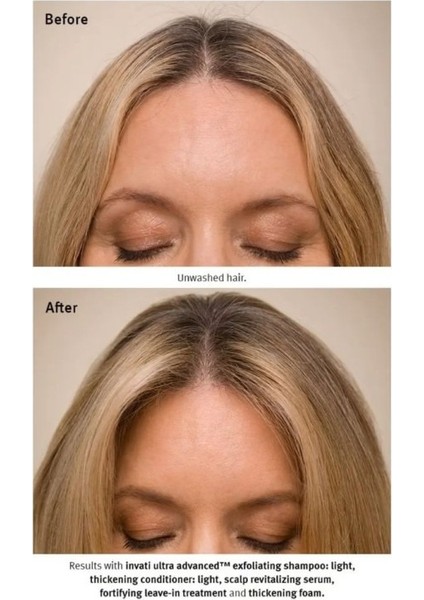 Invati Ultra Advanced Dökülme Karşıtı Saç Serumu 30ML fırsatları