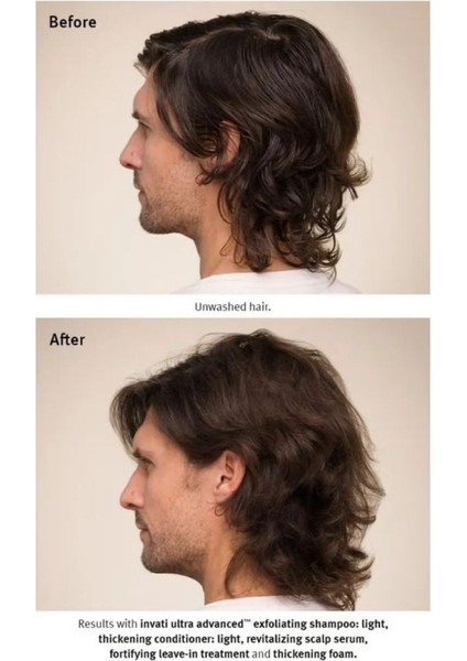 Invati Ultra Advanced Dökülme Karşıtı Saç Serumu 30ML