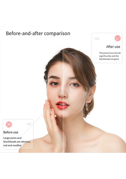 Elektrikli Siyah Nokta Sökücü Yüz Sivilce Çıkarma Yüzü Derin Noktalar Gözenek Sivilce Çıkarma Temizleyici Yüz Temizleyici (Yurt Dışından)