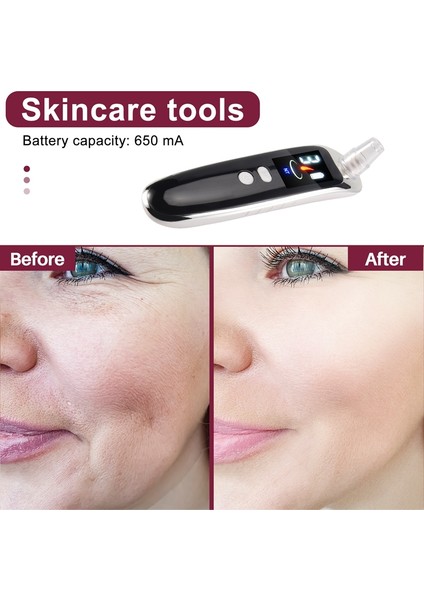 Yüz Burun Akne Siyah Dot Sivil Siyah Head Sökücü Elektrikli Siyah Kafa Elektrikli Temizleyici Gözenek Cilt Bakım Araçları Makine 6 Başlı (Yurt Dışından) indirimleri