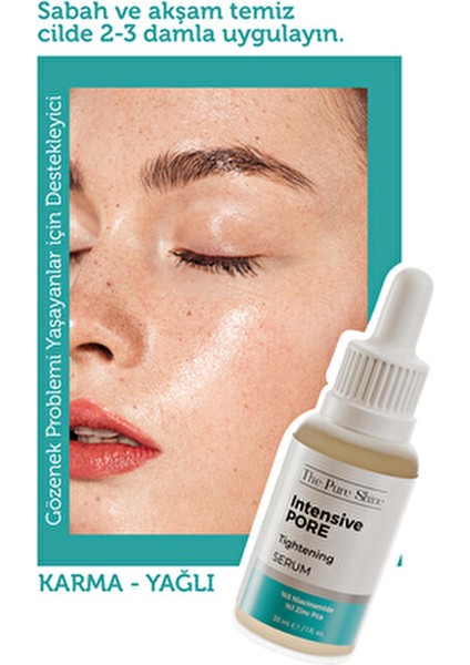 Cilt Bakım Serumu Niacinamide ile Siyah Nokta Karşıtı 30 ml Karma Ciltler İçin indirimleri