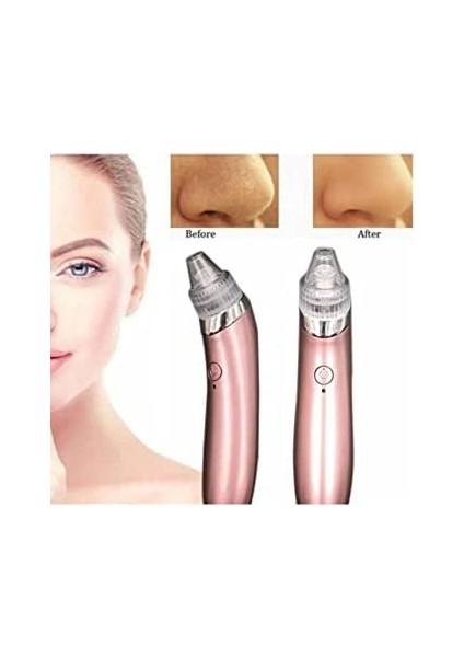 Mobee Profesyonel Vakumlu Siyah Nokta Akne Cilt Temizleme Cihazı fiyatları