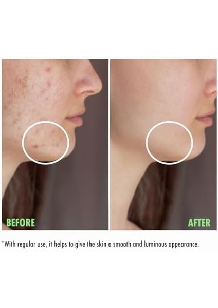 Maru.derm Karma ve Yağlı Ciltler Için Yüz Yıkama Jeli 200 ml fiyatları