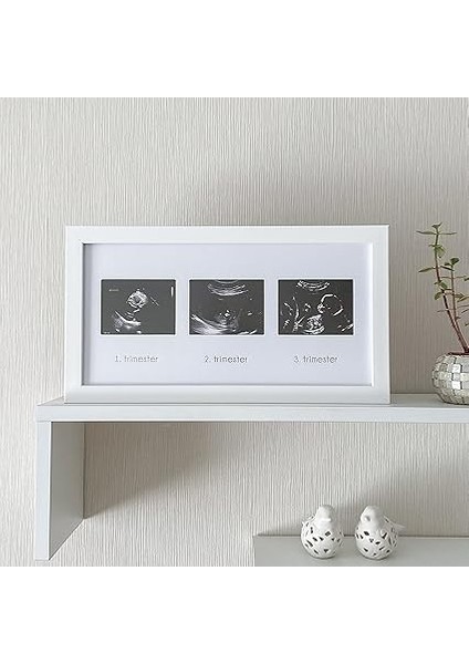 Üçlü Ultrason Anı Çerçevesi - Gebelikte Bebeğin Gelişimini Üç Trimester Anı Olarak Saklayın fiyatları