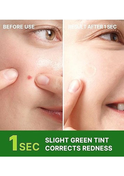 Ince Şeffaf Suya Dayanıklı%98 Çay Ağacı Özlü Kore Üretimi 96'lı Akne ve Sivilce Bandı fırsatları