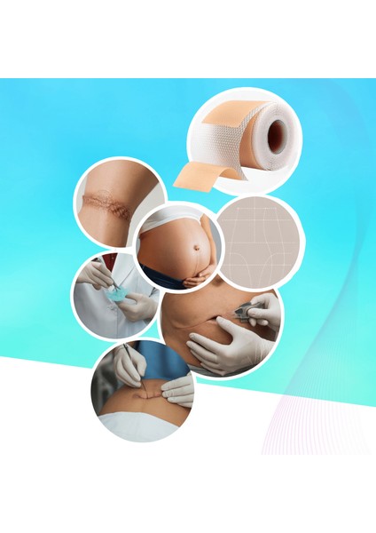 Premium Soft Silikon Yara Izi Bandı 2’li Set 3 M – 2,5 cm Genişlik, Ameliyat/sezaryen/skar fırsatları