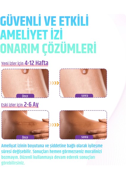 Premium Soft Silikon Yara Izi Bandı 2’li Set 3 M – 2,5 cm Genişlik, Ameliyat/sezaryen/skar indirimleri