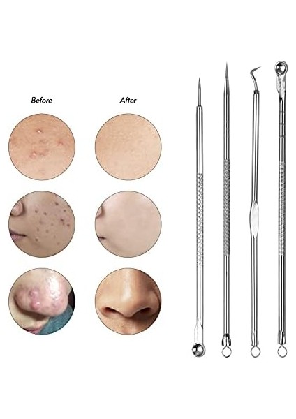 Galori Siyah Nokta Çıkarıcı Aracı Siyah Nokta Remover Sivilce Popper Sivilce Leke Için Araç Kiti Komedone Akne Zit Whitehead Yüz Çene Noze Alın Yanak Vücut fiyatları