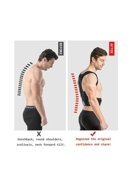 Ankawood Dik Duruş Ortopedik Dik Duruş Korsesi Dik Duruş Aparatı Kamburluk Önleyici Korse fiyatları