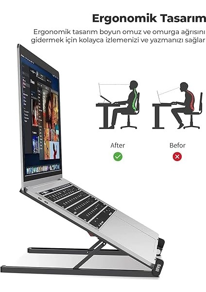 Saiji X2 Taşıma Çantalı Alüminyum Notebook Laptop Standı Gümüş fiyatları