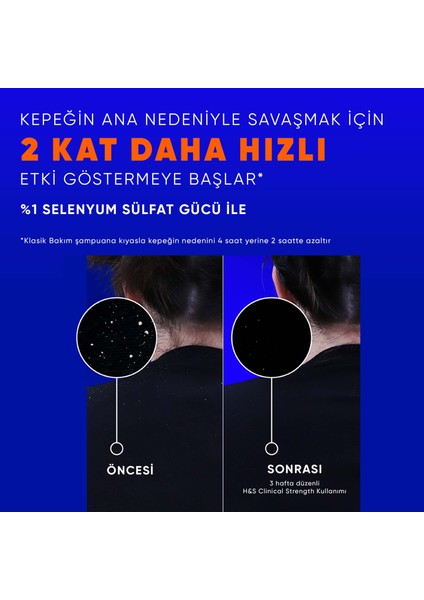 Head & Shoulders Clinical Strength Dry Scalp Rescue Kuru Saç Derisine Özel Şampuan 400 ml