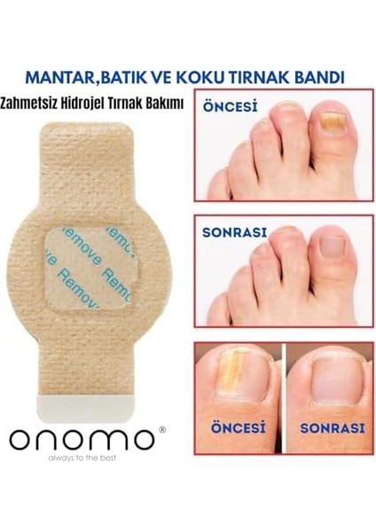 Onomo Tırnak Mantarı Bandı, Hidrojel Tırnak Bakımı 5 Adet
