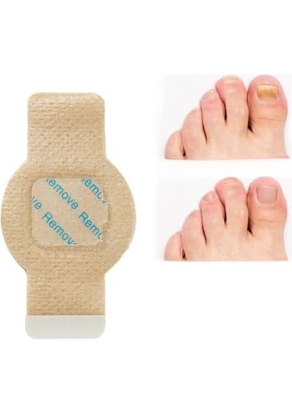 Onomo Tırnak Mantarı Bandı, Hidrojel Tırnak Bakımı 5 Adet fiyatları