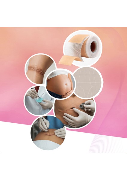 Silikon Yara Izi Bandı 2m – Premium Ameliyat/sezaryen/skar Iz Görünümü Için, Kesilebilir Medikal fırsatları