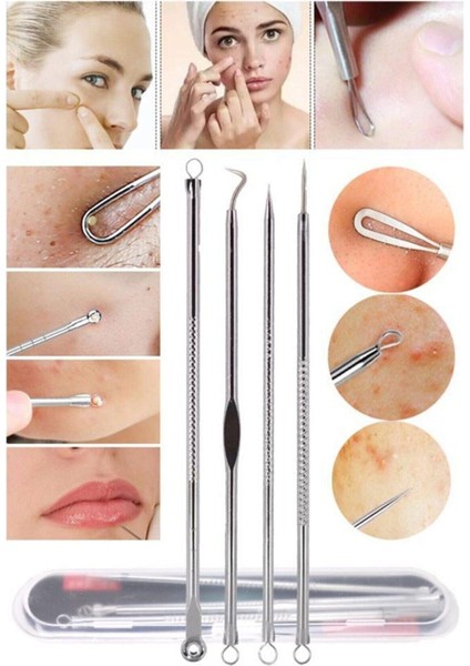 4 Lü Kutulu Paslanmaz Komedon Akne - Siyah Nokta Temizleyici Set