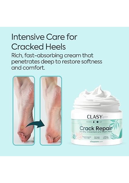 Topuk Çatlağı Kremi – Kuru ve Çatlamış Topuklar Için – E Vitamini ve Avokado Yağlı Topuk Kremi – Nasır, Sert ve Ölü Deriler Için Nemlendirici Ayak Bakım Kremi – 100 ml fiyatları
