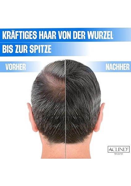 Antı-Haır Loss Shampoo Erkek Saç Bakım Şampuanı (300 Ml) fırsatları