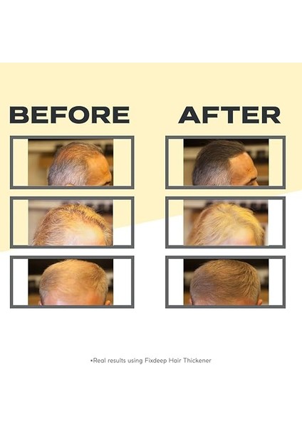 Yeni Nesil Saç Dolgunlaştırıcı Pudra 14 Gr. | Seyrek Saçlar Için Saç Fiberi | Fixdeep Suda Çıkmaz (Koyu Kahve) modelleri