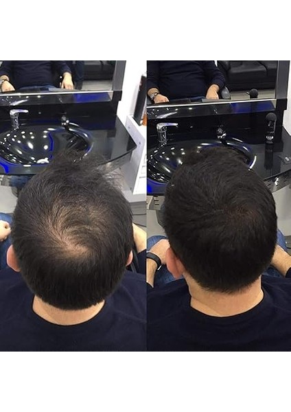 Dolgunlaştırıcı Saç Fiber Tozu 27,5gr Siyah/black indirimleri