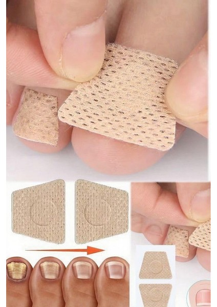 5 Çift Mantar Tırnak Yaması – Ayak ve El Tırnakları Için Güçlü Mantar Tedavisi, Tırnak Yenileyici fiyatları