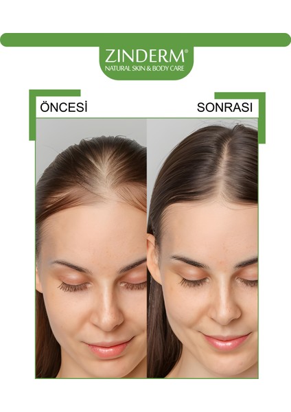 Saf Biberiye Suyu Saç Toniği Dökülme Karşıtı ve Saç Uzamasını Destekleyici Tonik 150 ml indirimleri