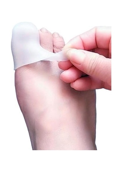 Bunyon Ayak Başparmak Silikon Hortum Koruyucu Makarasız Kemik Koruyucu Halluks Valgus