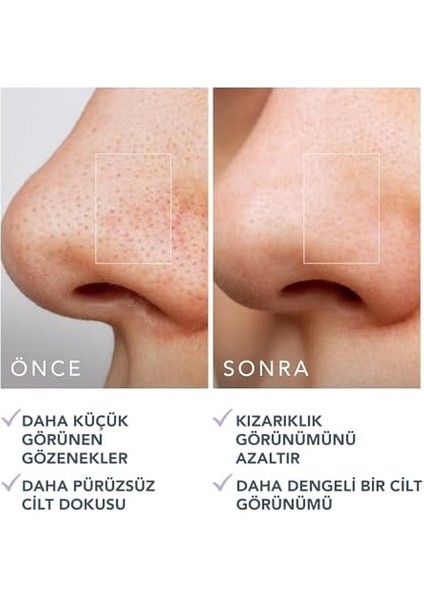 Foreo Kıwı Gözenek Minimizing Toner Pedleri 60 Adet – Witch Hazel & Centella Asiatica Peeling Yüz Pedleri, Yağ, Akne Taç Cilt Için – Gözenek Minimizer ve Redness Rölyef fiyatları