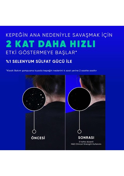 Head & Shoulders Clinical Strength Cooling Itch Rescue Kaşıntı Karşıtı Şampuan 400 ml fırsatları