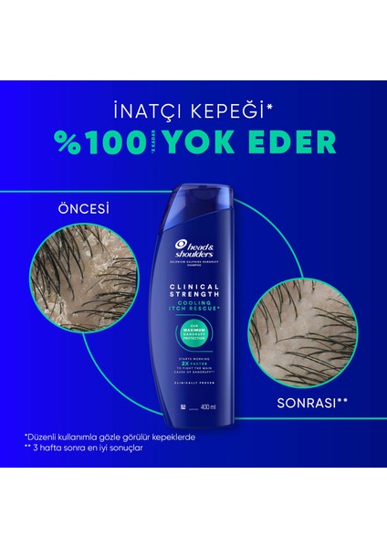 Head & Shoulders Clinical Strength Cooling Itch Rescue Kaşıntı Karşıtı Şampuan 400 ml