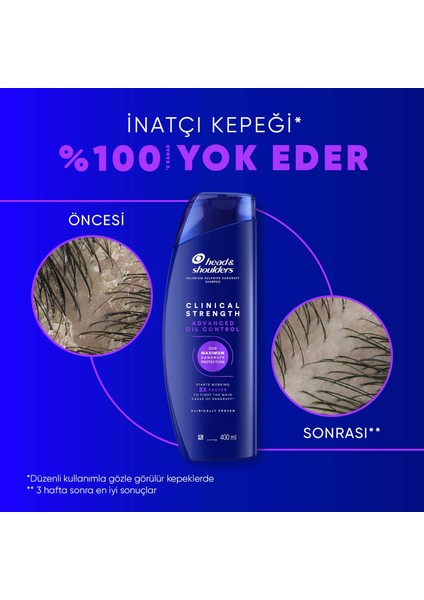 Head & Shoulders Clinical Strength Advanced Oil Control Yağ Dengeleyici Şampuan 400 ml