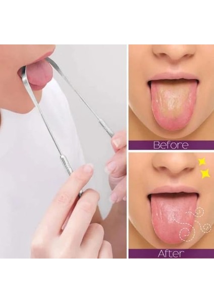 Jouis Dil Temizleyici, Paslanmaz Çelik Ağız ve Dil Temizleyici Aparat (Paslanmaz 1. Sınıf) fiyatları