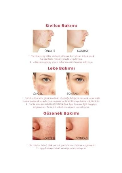 Procsın Hydro Solution Babypore Gözenek Sıkılaştırıcı & Canlandırıcı Tonik, %7 Glikolik Asit & Ginseng, Cilt Yenileyici & Arındırıcı, Tüm Cilt Tipleri Için, 200 ml