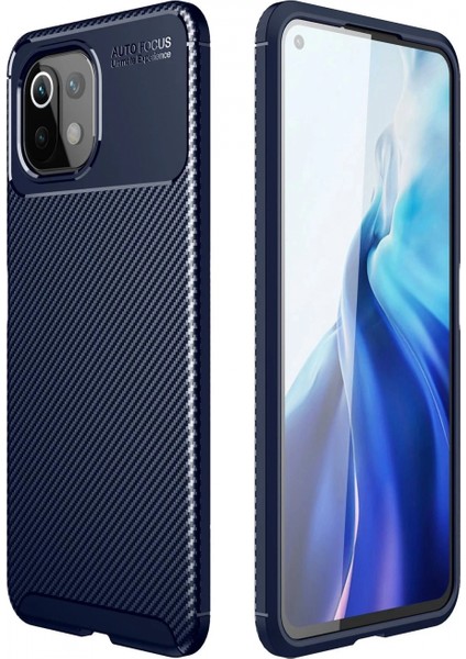 Xiaomi Mi 11 Lite Kılıf Auto Focus Karbon Kapak - Lacivert (K95)