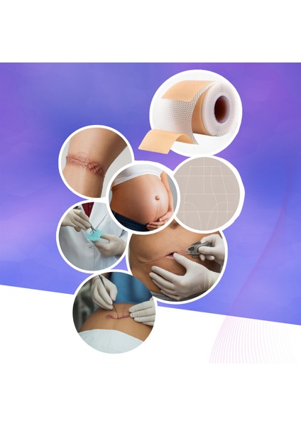 Soft Silikon Bant, Silikonlu Yara İzi Giderici Bandı 3m, Skar Ameliyat Sezeryan Yanık Cerrahi İzler için indirimleri