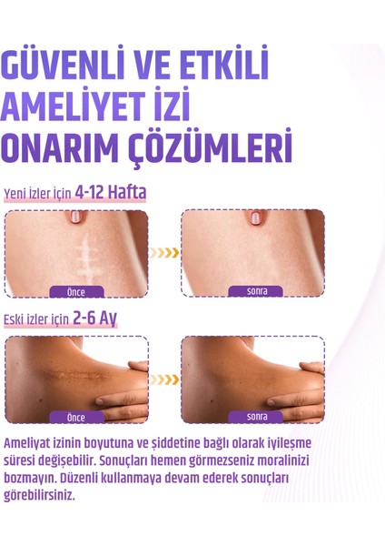 Soft Silikon Bant, Silikonlu Yara İzi Giderici Bandı 3m, Skar Ameliyat Sezeryan Yanık Cerrahi İzler için