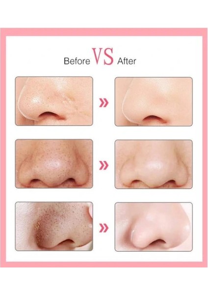 Buğz 6 Başlıklı Vakumlu Siyah Nokta Temizleyici fiyatları