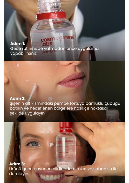 Akne Karşıtı Losyon 30ml – Akne Yatıştırıcı, Siyah Nokta Azaltıcı Vegan (%5 Calamine – Yeşil Çay) fiyatları