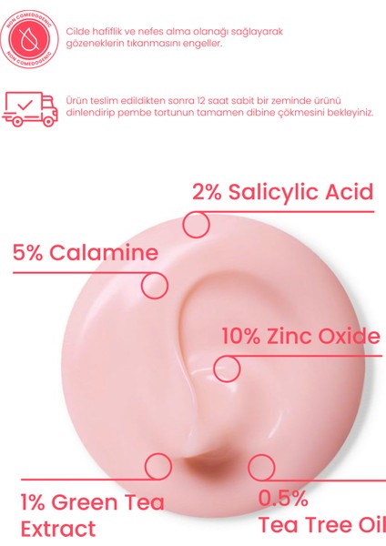 Akne Karşıtı Losyon 30ml – Akne Yatıştırıcı, Siyah Nokta Azaltıcı Vegan (%5 Calamine – Yeşil Çay) fırsatları